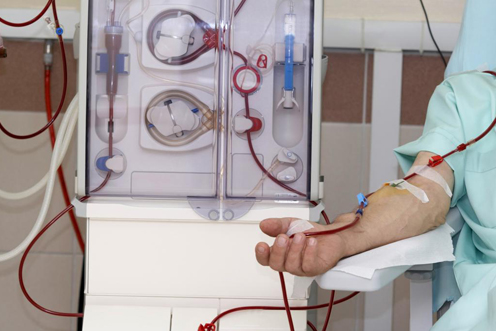 Retrograde Intrarenal Surgery