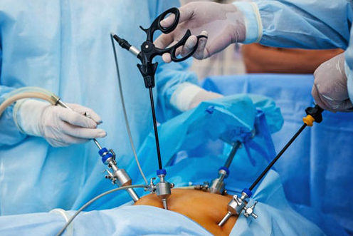 Retrograde Intrarenal Surgery