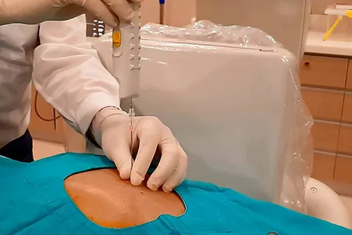 Retrograde Intrarenal Surgery