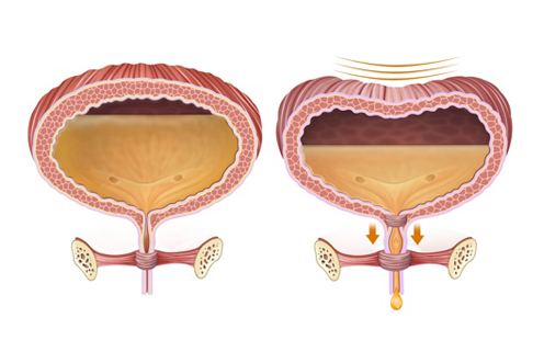 Anaesthesiology Services at HMHCARE